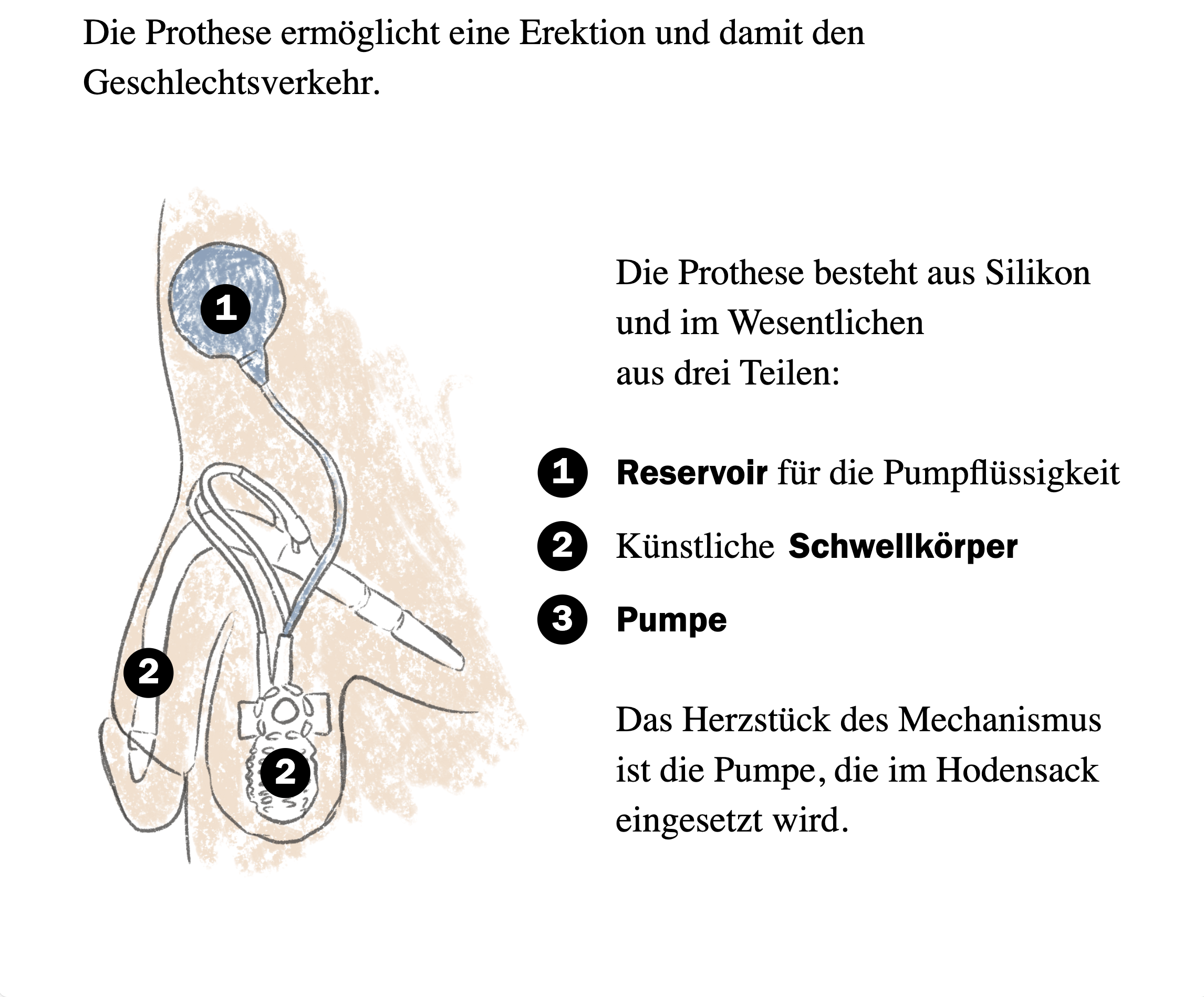 penispumpe im hoden Wie konstruiert man einen Penis, Herr Daverio? „Die Haut des Unterarms ist  am besten geeignet“